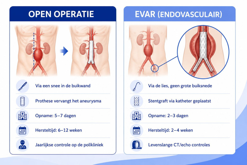 AAA operaties