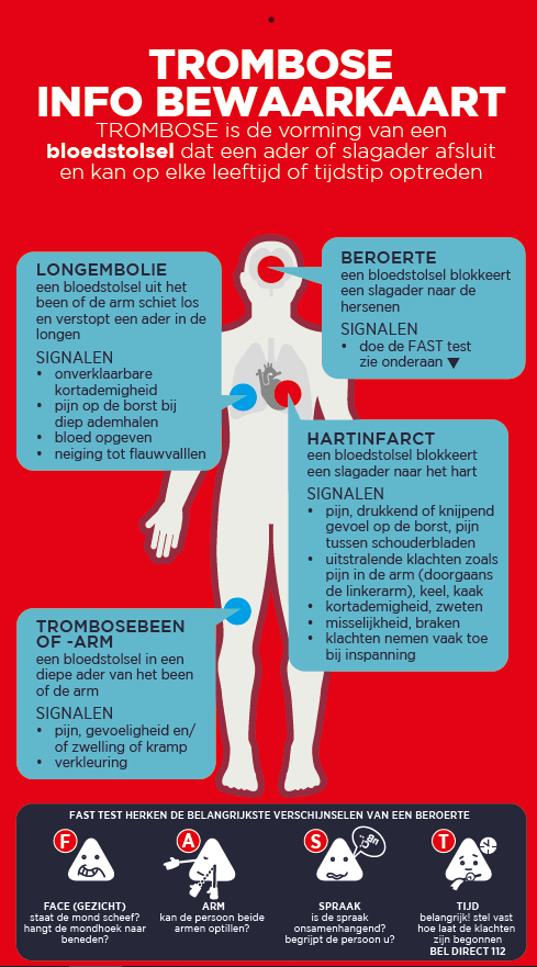 Bewaarkaart WTD 2